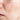 Pigmentation Image