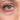 Dark circles images